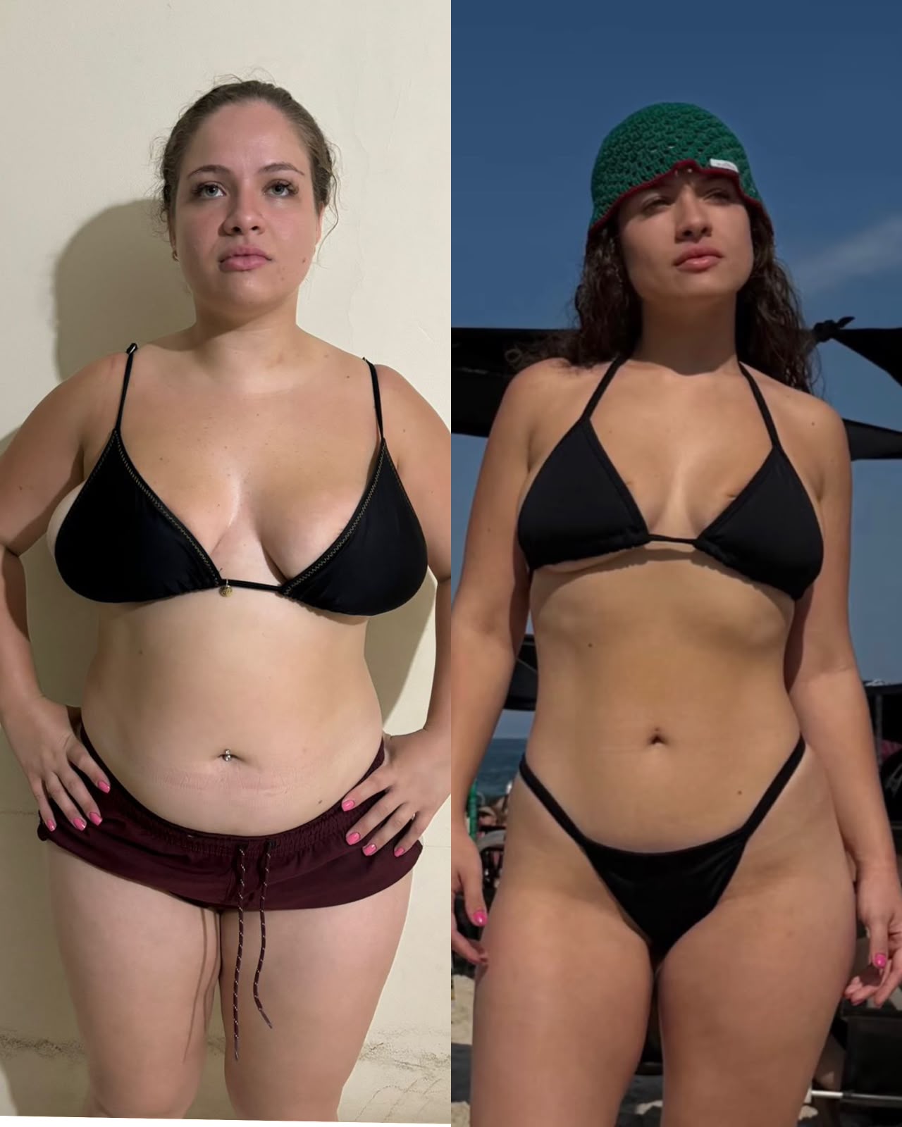 Resultado antes e depois de paciente do Método START