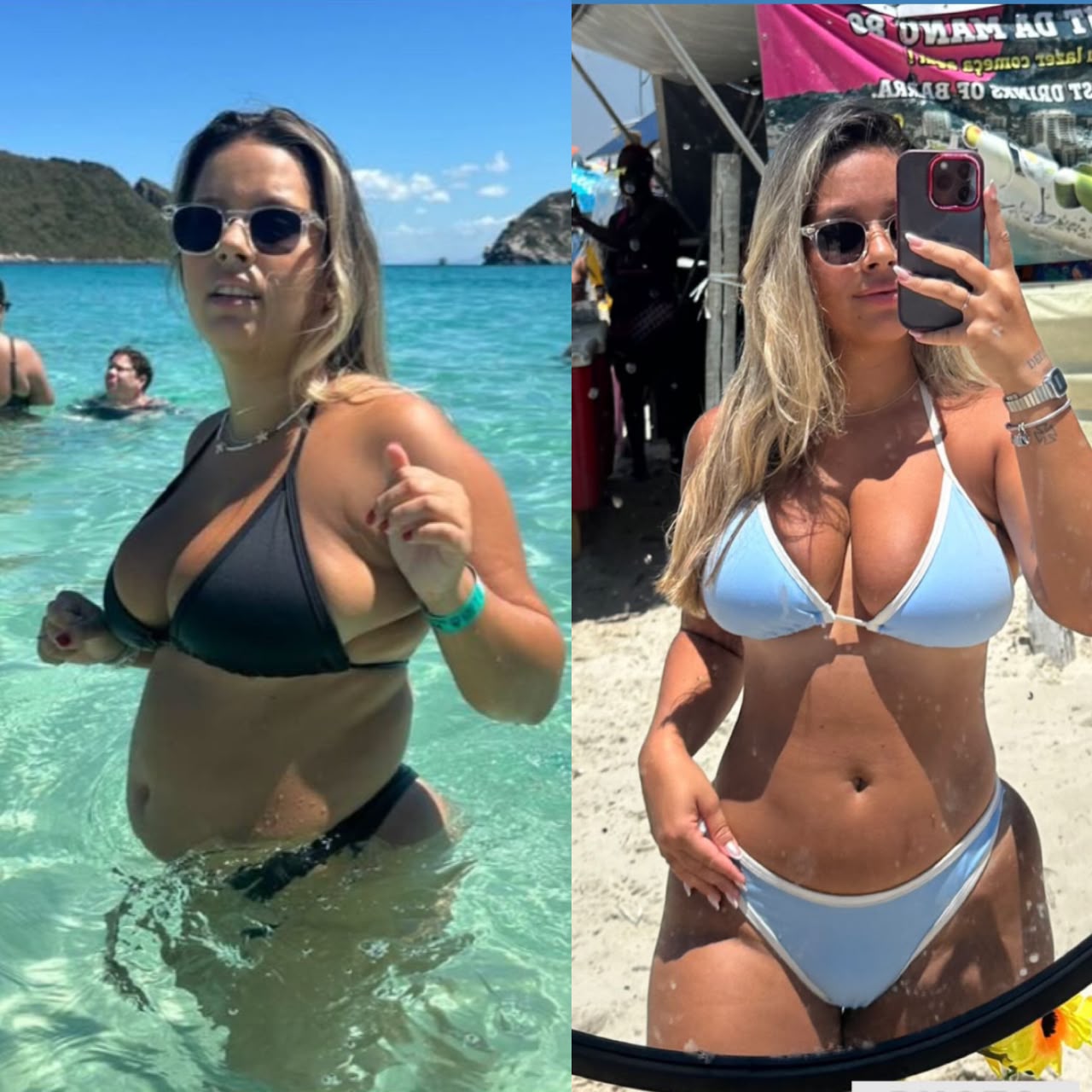 Resultado antes e depois de paciente do Método START