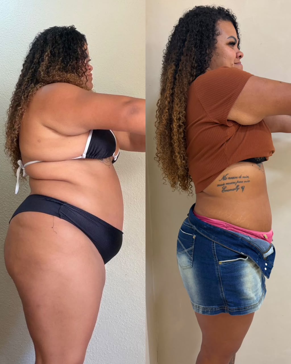 Resultado antes e depois de paciente do Método START